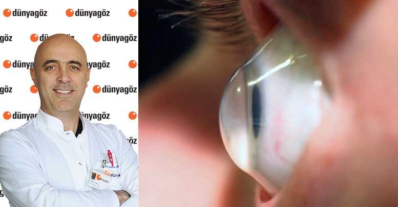 ‘KERATOKONUS’U GÖZ TEMBELLİĞİ İLE KARIŞTIRMAYIN