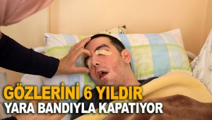 Gözlerini 6 yıldır yara bandıyla kapatıyor