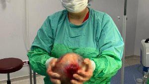 Rahminden 1,5 kiloluk kist çıktı