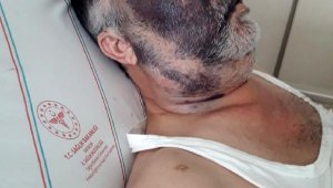 Engelli adam ile ailesini dövüp, şişeye oturtmakla tehdit ettiler