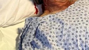 Kafesinden kaçan maymun, otel personelini yüzünden yaraladı