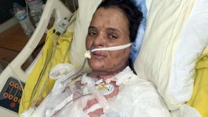 Dezenfektanın parlamasıyla yanan Havva, 75 gündür yoğun bakımda
