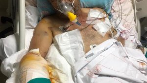 Eski muhtarın vurduğu ağabeyine, 300'e yakın saçma isabet etti