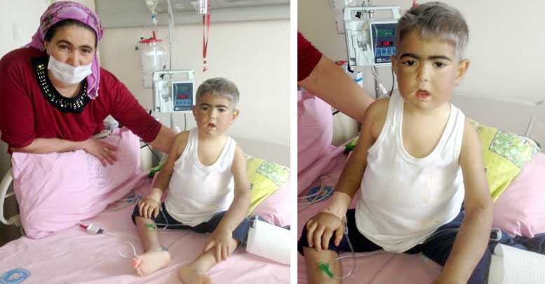 MEHMET EFE'Yİ YAŞATAMADIK