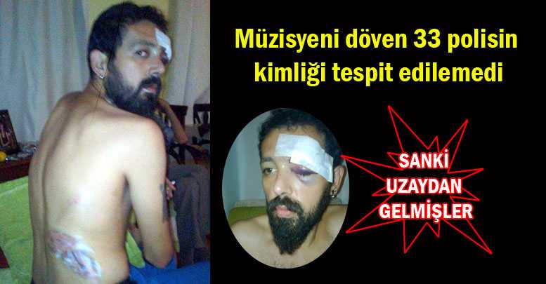 Müzisyeni döven 33 polisin kimliği tespit edilemedi
