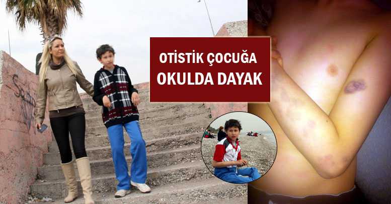 OTİSTİK ÇOCUĞA OKULDA DAYAK