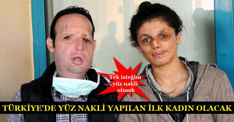 TÜRKİYE'DE YÜZ NAKLİ YAPILAN İLK KADIN OLACAK
