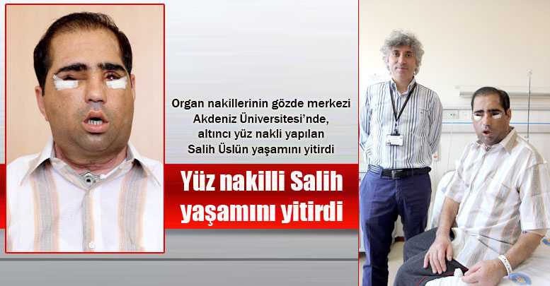 Yüz nakilli Salih yaşamını yitirdi